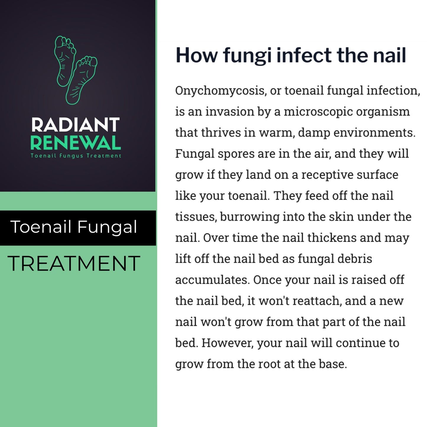 Radiant Renewal Toenail Fungal Treatment